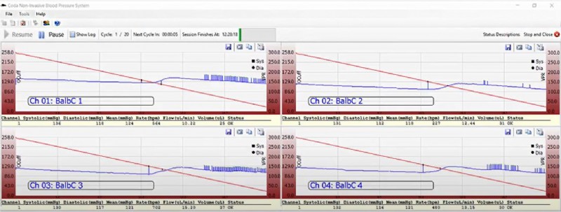 CODA® Data Acquisition Software