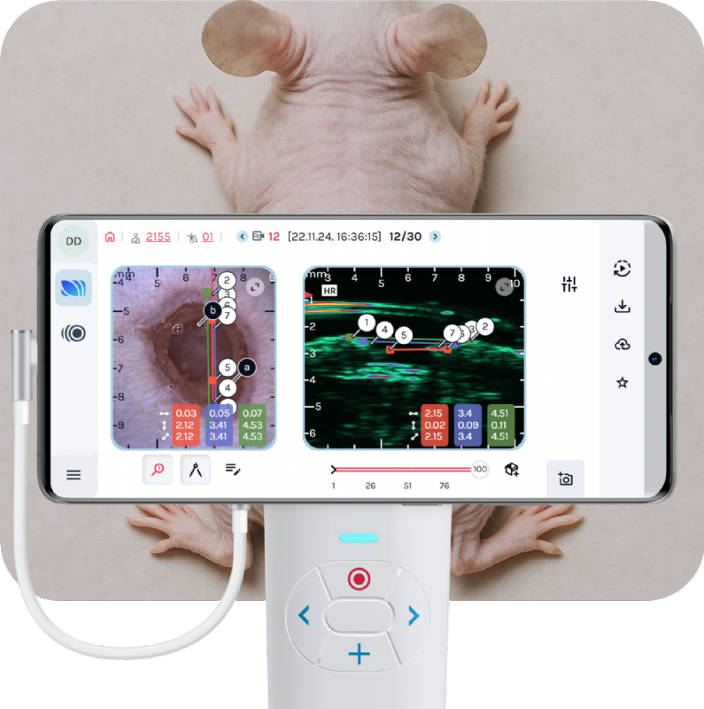 skinscanner with mouse