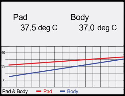 Rectal Temperature Chart