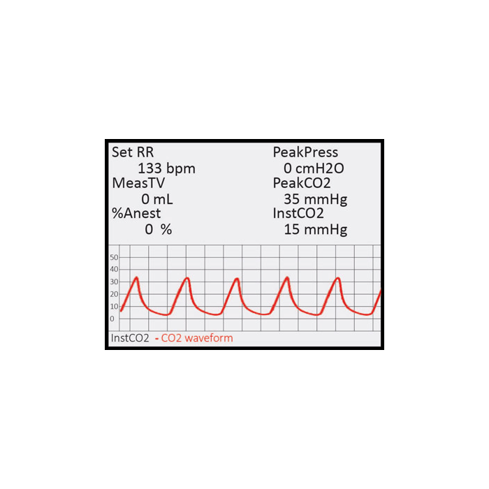 caposcan-screen 1 CapnoScan® NFC